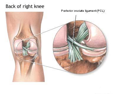 Ligamentul incrucisat posterior